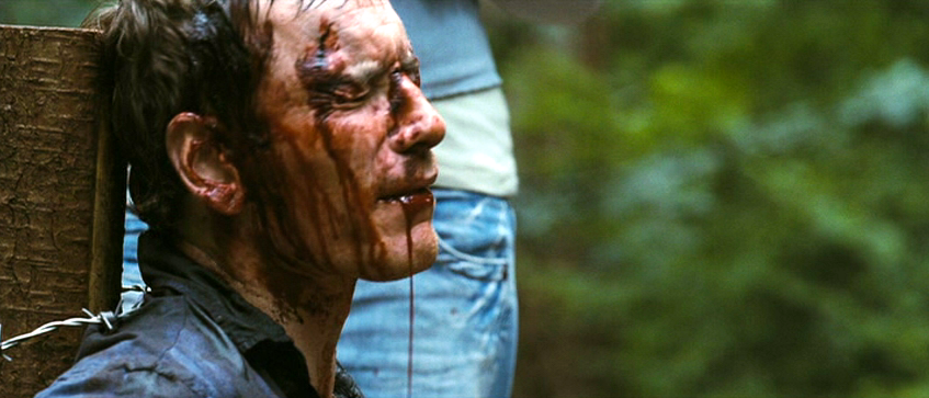 Steve suffers after Cooper, a member of the chav gang, is forced by the ringleader Brett to attack Steve's mouth with a box-cutting knife.